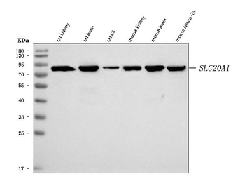 Anti-SLC20A1 Antibody