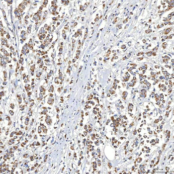 Anti-SLC20A1 Antibody
