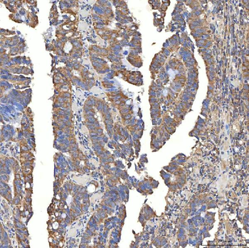 Anti-SLC20A1 Antibody