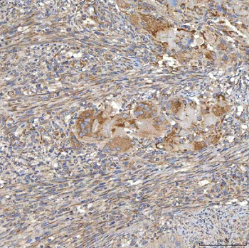 Anti-SLC20A1 Antibody