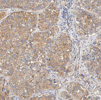 Anti-SLC20A1 Antibody