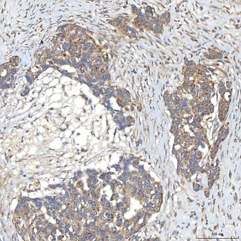 Anti-SLC20A1 Antibody