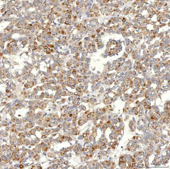 Anti-SLC20A1 Antibody