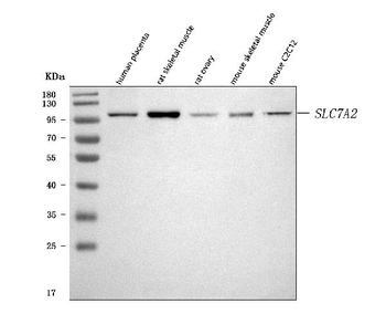 Anti-CAT2/SLC7A2 Antibody
