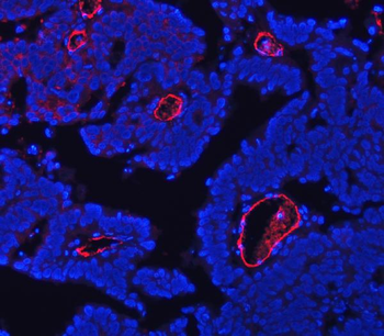 Anti-CD105/ENG Antibody