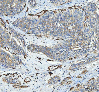 Anti-CD105/ENG Antibody