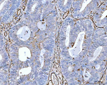 Anti-CD105/ENG Antibody