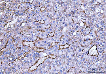Anti-CD105/ENG Antibody