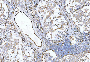Anti-CD105/ENG Antibody