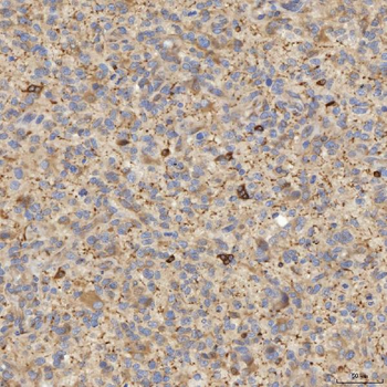 Anti-EIF2AK1 Antibody