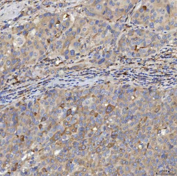 Anti-EIF2AK1 Antibody