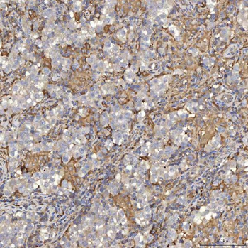 Anti-EIF2AK1 Antibody