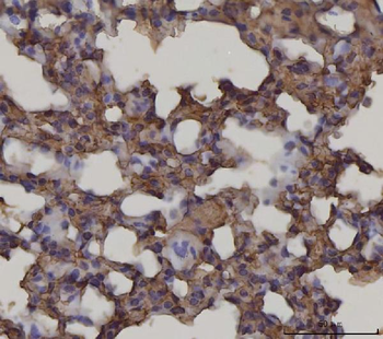 Anti-RAGE/AGER Antibody (monoclonal, 5C6C1)