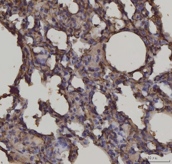 Anti-RAGE/AGER Antibody (monoclonal, 5C6C1)