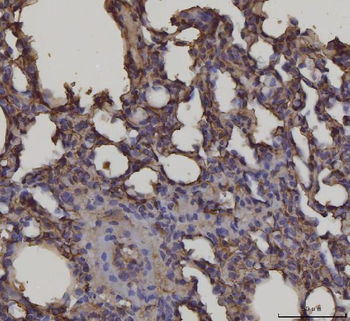 Anti-RAGE/AGER Antibody (monoclonal, 5C6C1)