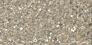 Anti-Aspartate Aminotransferase/GOT1 Antibody (monoclonal, 6B3B4)