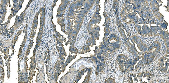 Anti-Aspartate Aminotransferase/GOT1 Antibody (monoclonal, 6B3B4)