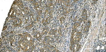 Anti-Aspartate Aminotransferase/GOT1 Antibody (monoclonal, 6B3B4)