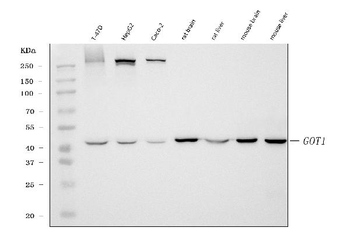 Anti-Aspartate Aminotransferase/GOT1 Antibody (monoclonal, 6B3B4)