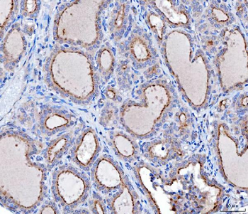 Anti-KLHL12 Antibody (monoclonal, 2G11D1)