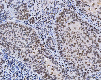 Anti-Lamin A+C/LMNA Antibody (monoclonal, 5F3C12)
