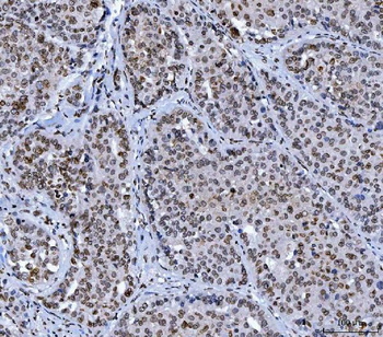 Anti-Lamin A+C/LMNA Antibody (monoclonal, 5F3C12)