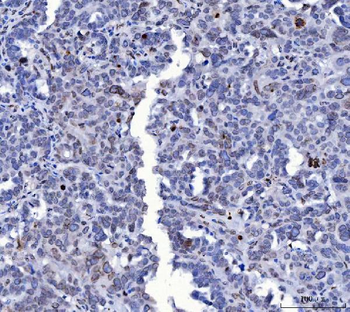 Anti-Lamin A+C/LMNA Antibody (monoclonal, 5F3C12)