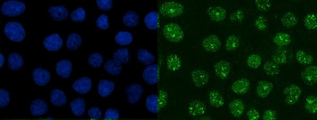 Anti-XRCC1 Antibody (monoclonal, 10E10)