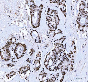 Anti-CTBP2 Antibody (monoclonal, 7F3E1)