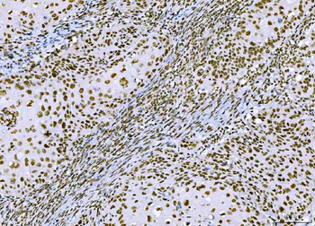 Anti-CTBP2 Antibody (monoclonal, 7F3E1)