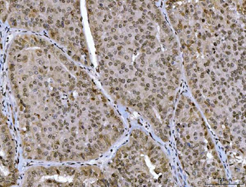Anti-CTBP2 Antibody (monoclonal, 7F3E1)