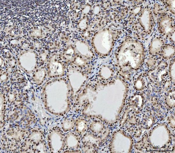 Anti-CTBP2 Antibody (monoclonal, 7F3E1)