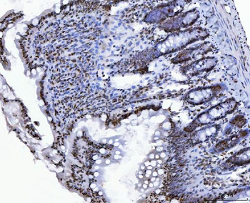 Anti-CTBP2 Antibody (monoclonal, 7F3E1)