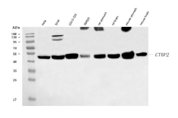 Anti-CTBP2 Antibody (monoclonal, 7F3E1)