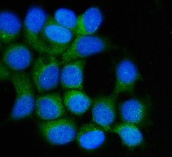 Anti-Hsp90 beta/HSP90AB1 Antibody (monoclonal, 7B7F5)