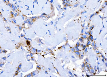 Anti-Desmoglein 2/DSG2 Antibody (monoclonal, 2B4D1)