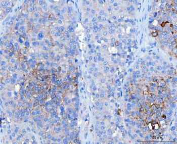 Anti-Desmoglein 2/DSG2 Antibody (monoclonal, 2B4D1)