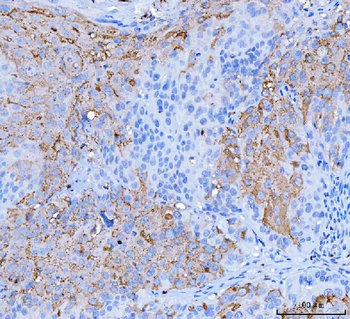 Anti-Desmoglein 2/DSG2 Antibody (monoclonal, 2B4D1)