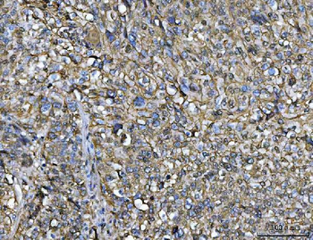 Anti-Annexin A1/ANXA1 Antibody (monoclonal, 6B7F8)
