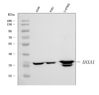 Annexin A1/ANXA1 Antibody (monoclonal, 6B7F8)