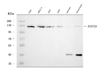 RNF20 Mouse Monoclonal Antibody