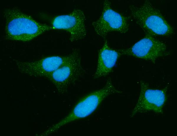 Anti-PARK7/DJ1 Antibody (monoclonal, 4B10)