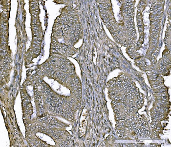 Anti-PARK7/DJ1 Antibody (monoclonal, 4B10)