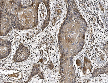 Anti-PARK7/DJ1 Antibody (monoclonal, 4B10)