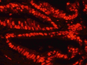 Goat Anti-Rabbit IgG (H+L) Secondary Antibody, TRITC Conjugated