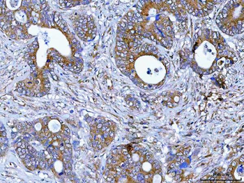 Anti-PDXDC1 Antibody