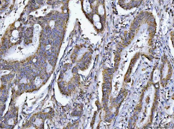 Anti-PCCB Antibody
