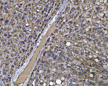 Anti-PCCB Antibody