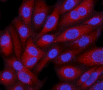 Anti-C19orf61/SMG9 Antibody