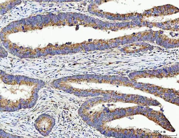 Anti-TSEN54 Antibody
